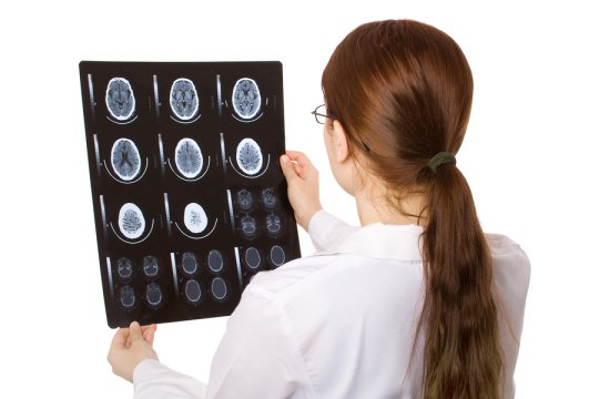 Brain Injury compensation by Bakerink, McCusker, & Belden Law